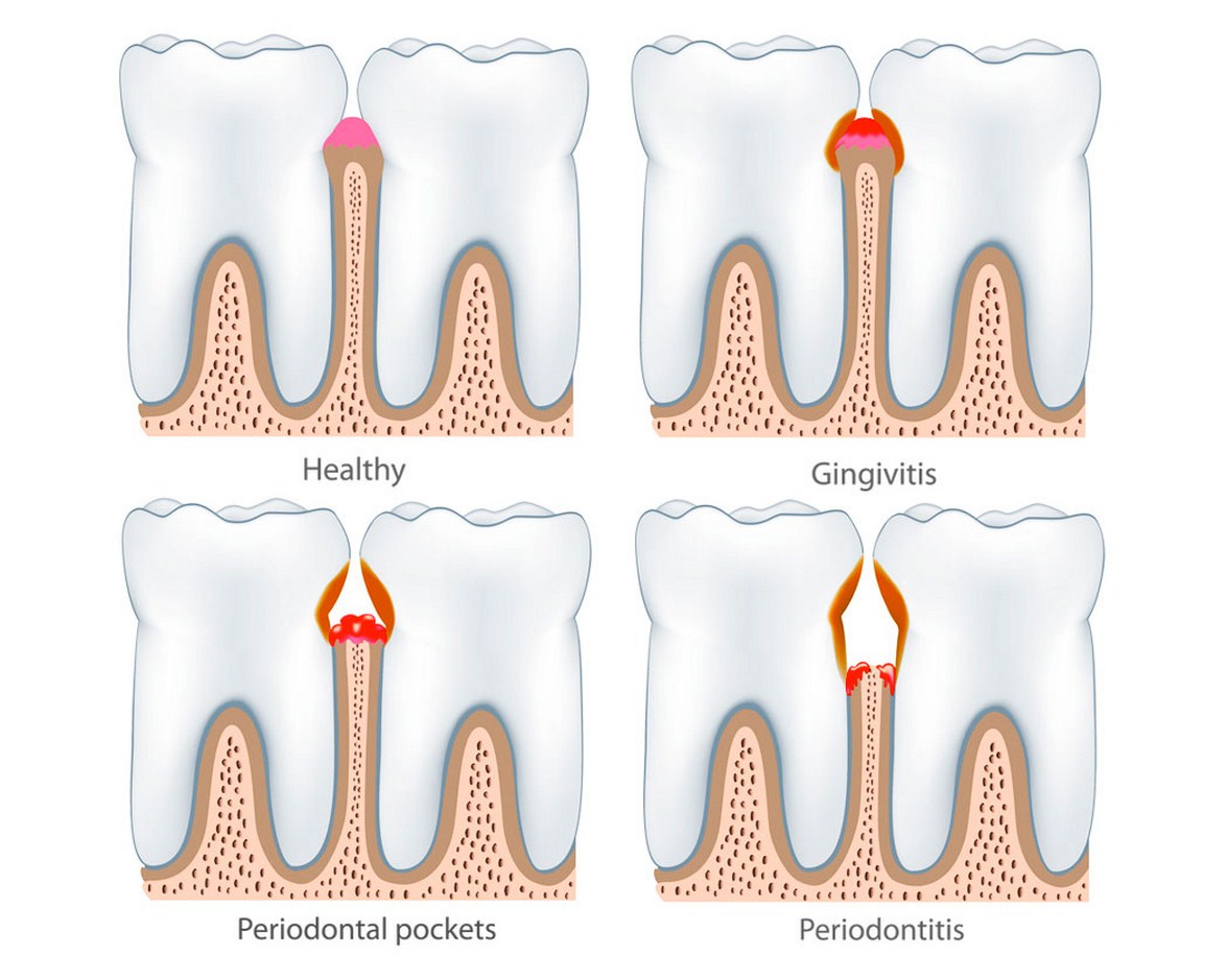 periodontology